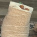 Surgery Complete