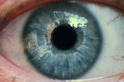 11th May 2011 - Alex's eye