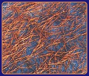 18th Nov 2011 - Pine Straw Pattern
