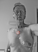 22nd Dec 2011 - 3M Red Dots (mystery illness 2)