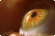 26th Feb 2012 - Eye