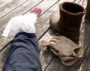 3rd Mar 2012 - Ankle on ice...