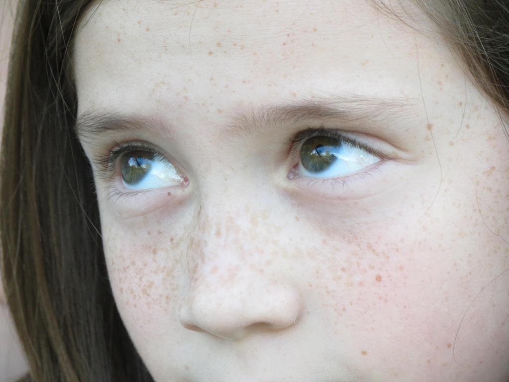 Freckle Face by grammyn