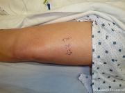 29th Mar 2012 - Leg Art