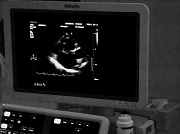 28th May 2012 - Echo scan