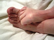 19th Sep 2012 - horrible feet