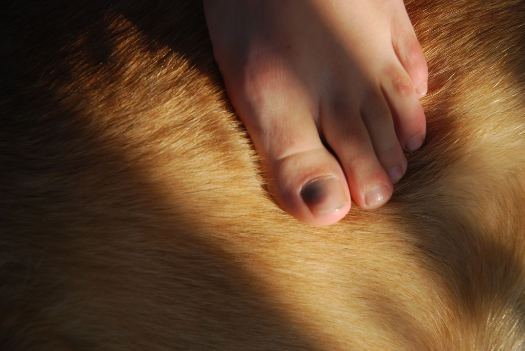 Becca's sore toe by farmreporter