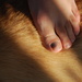 Becca's sore toe by farmreporter