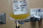 15th Nov 2012 - Have you ever seen platelets?