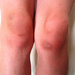 7 year old knees by spanner