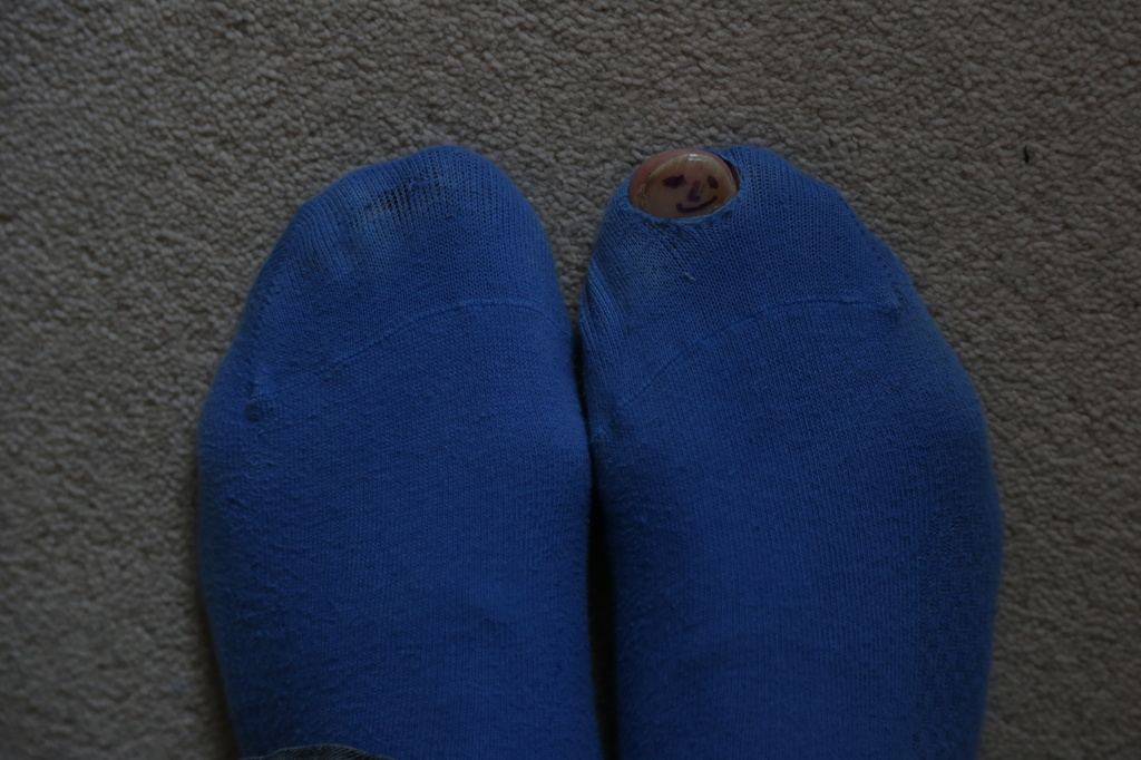 Look down and see a big hole in my sock by padlock