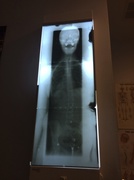 5th Mar 2014 - X-ray