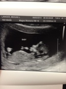3rd Jun 2014 - First picture of my new great-niece or nephew!