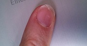 25th Feb 2015 - Dammit!  Broke a nail!