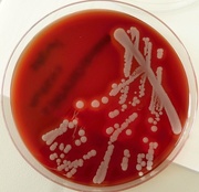 25th Mar 2015 - Bacteria