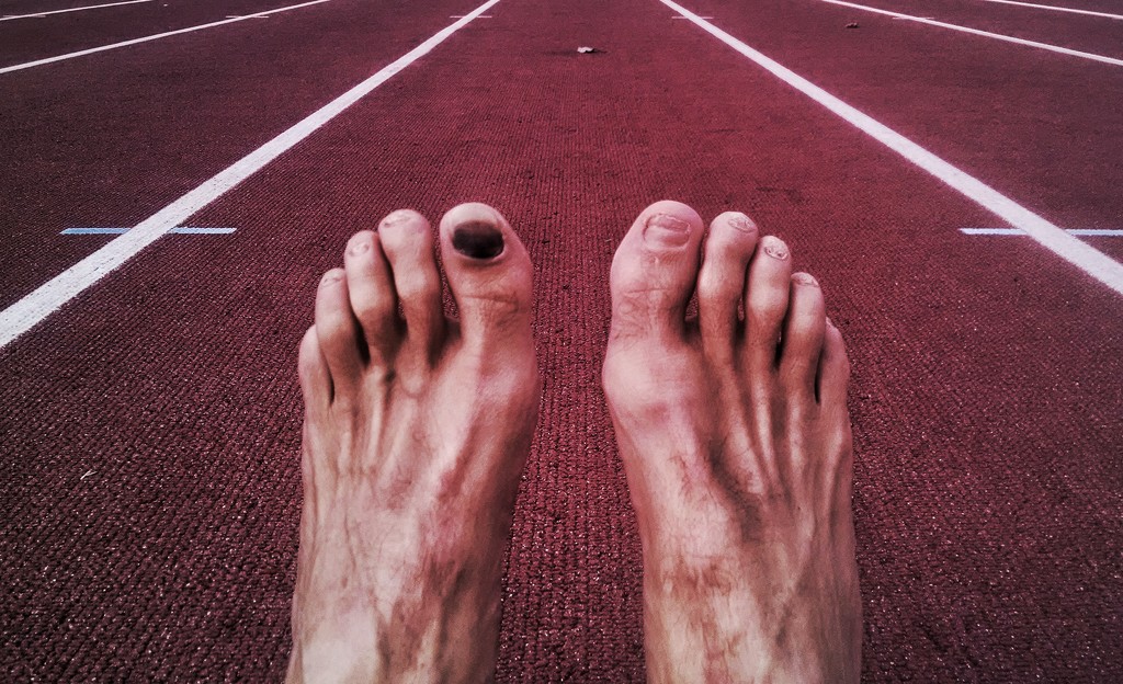 Typical runner's foot by scottmurr