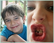 1st Jan 2011 - Collage H first tooth