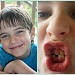 Collage H first tooth by corymbia