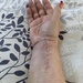 My Poor Arm by kjarn