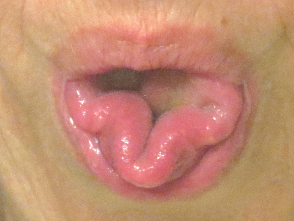 Cloverleaf Tongue by grammyn