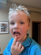 27th Jan 2019 - First tooth has come out
