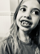 15th Jun 2019 - Tooth #6 gone
