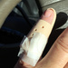 Broken Finger by nickspicsnz