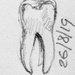 Tooth Ache by harveyzone