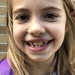Tooth #8 gone. She lost the tooth on the playground at school  by mdoelger