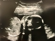 28th Oct 2019 - 20-week ultrasound 