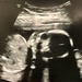20-week ultrasound  by gratitudeyear