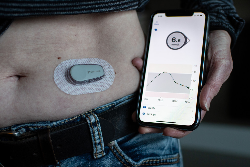 Newest Diabetic Gadget by kwind