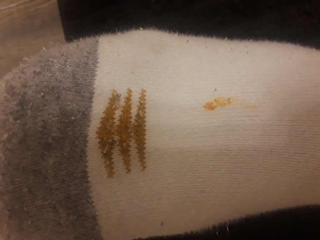I fell asleep with pasta sauce on my sock by digitalfairy