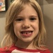 Lost her first tooth 🦷  by mdoelger