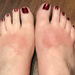 Oh, my sunburned feet! by homeschoolmom