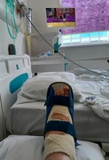 15th Jun 2021 - The bandage and the boot