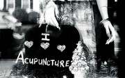 8th Jul 2021 - Acupuncture