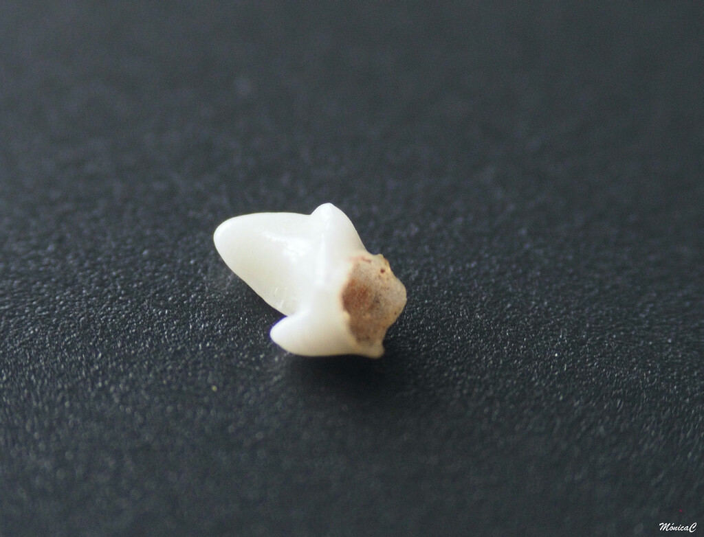 Teo's baby tooth by monicac