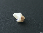 21st Aug 2021 - Teo's baby tooth