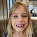 Another tooth gone  by mdoelger