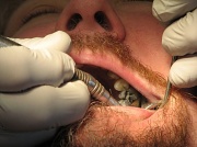 22nd Feb 2010 - Dennis at the Dentist