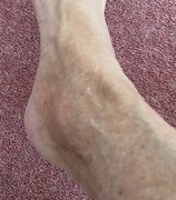 25th May 2022 - Ankle