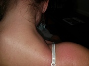 3rd Jun 2022 - Sunburn after send off for Mosher and lunch w mom