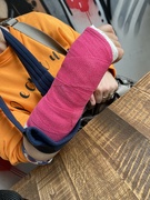 18th May 2023 - A pink cast  now