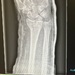 My X-ray  by bizziebeeme