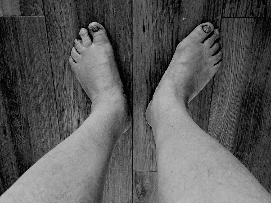 A brutally honest portrait of feet by allsop