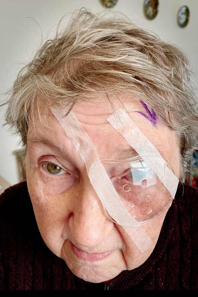 Beryl after her first cataract operation  by allsop