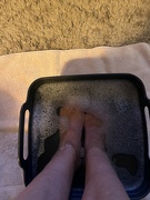 2nd Jan 2024 - Feet treatment....