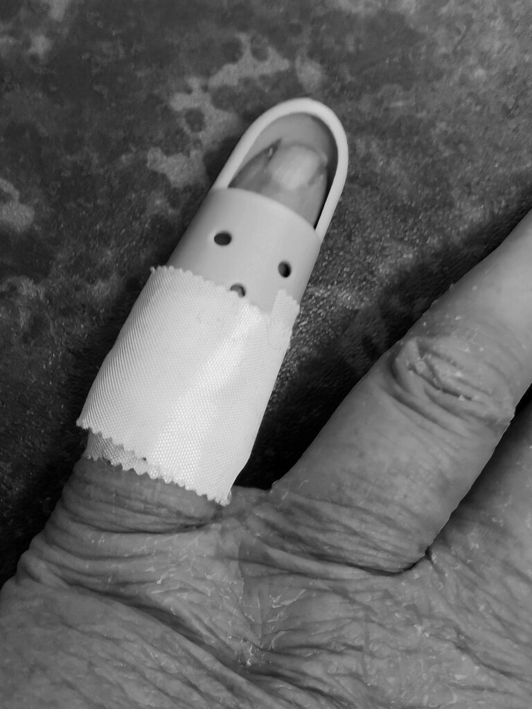 Damaged Finger by plainjaneandnononsense