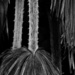 Dead Palm Tree Fronds